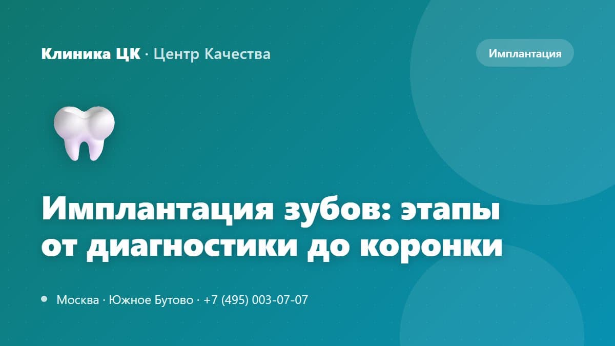 Имплантация зубов: этапы от диагностики до установки коронки